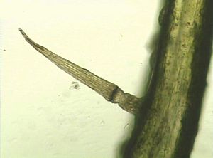 Dionaea-muscipula-Ausloeseborste-Mikroskopaufnahme