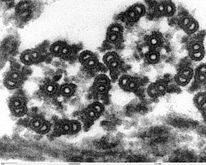 Chlamydomonas TEM 17