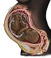 PregnancyinCrossSection