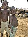 Niger childhood malnutrition 16oct06