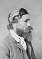 Robert McGee, scalped as a child by Sioux Chief Little Turtle in 1864-2