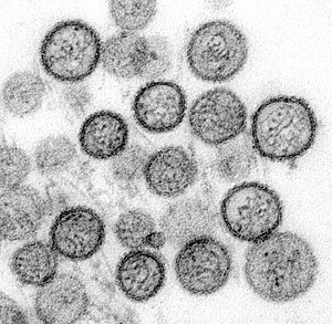 Transmission electron micrograph of "Sin Nombre virus"
