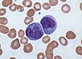 Monocytes, a type of white blood cell (Giemsa stained)