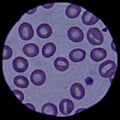 Blood cells 090304-F-5951M-108