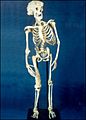Joseph Merrick skeleton