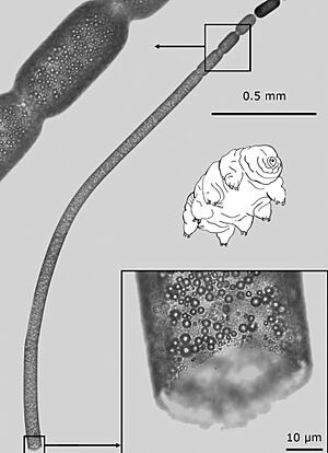 Morphology and ultrastructure of Ca. T. magnifica