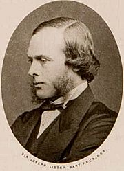 Joseph Lister2