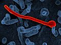 Ebola virus Makona from West African Epidemic (43234028254)