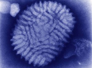 Myxoma virus (transmission electron microscope).jpg