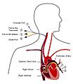 Pulmonary artery catheter english
