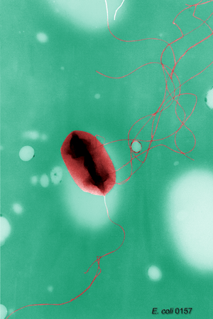 Escherichia coli flagella TEM