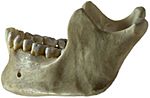 Human jawbone left