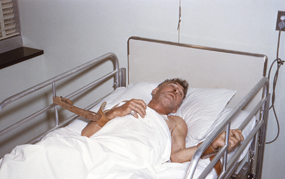 A man with rabies in a hospital.