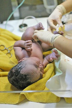 Umbilical-newborn