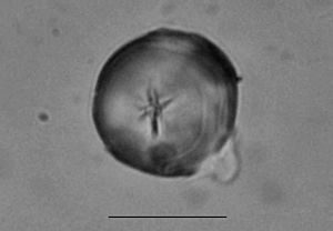 Almidon arqueologico de Zamia amblyphyllidia Artef. 4. UTU-27