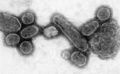An electron micrograph of the virus that caused Spanish influenza