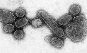 Reconstructed Spanish Flu Virus