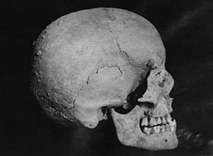 Skulls of Avicenna