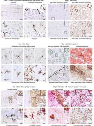 Step-by-step guide for analyzing microglia phenotypes