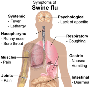 Symptoms of swine flu