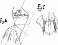 Corset a membrane abdominale