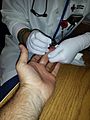 Hemoglobin Test American Red Cross