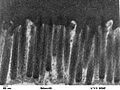Human jejunum microvilli 2 - TEM