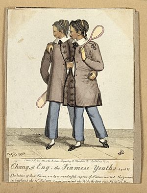 Chang and Eng the Siamese twins, aged eighteen, with badmint Wellcome V0007365