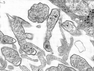 Mumps virions, thin sectioned TEM 8757 lores