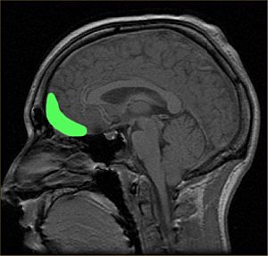 MRI of orbitofrontal cortex