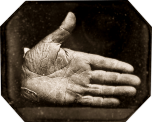 Jonathan Walker branded hand, 1845