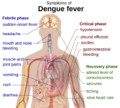 Dengue fever symptoms