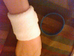 Wristbandtypes